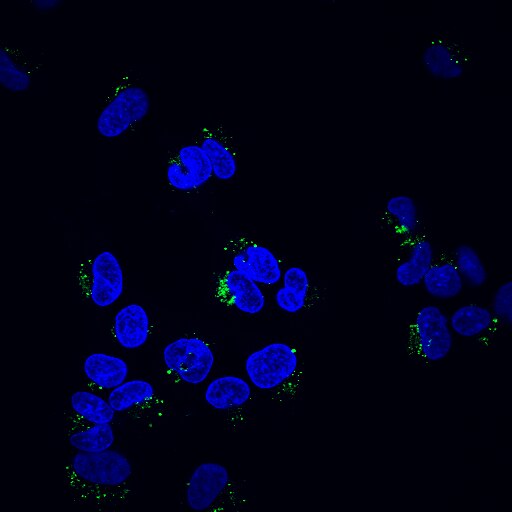 Beta-Amyloid (1-42) Human CAS 107761-42-2 Applications | Shaanxi BLOOM Tech Co., Ltd Beta-Amyloid (1-42) Human CAS 107761-42-2 Applications | Shaanxi BLOOM Tech Co., Ltd